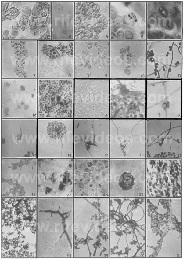 Cryptomyces Pleomorpha Fungi